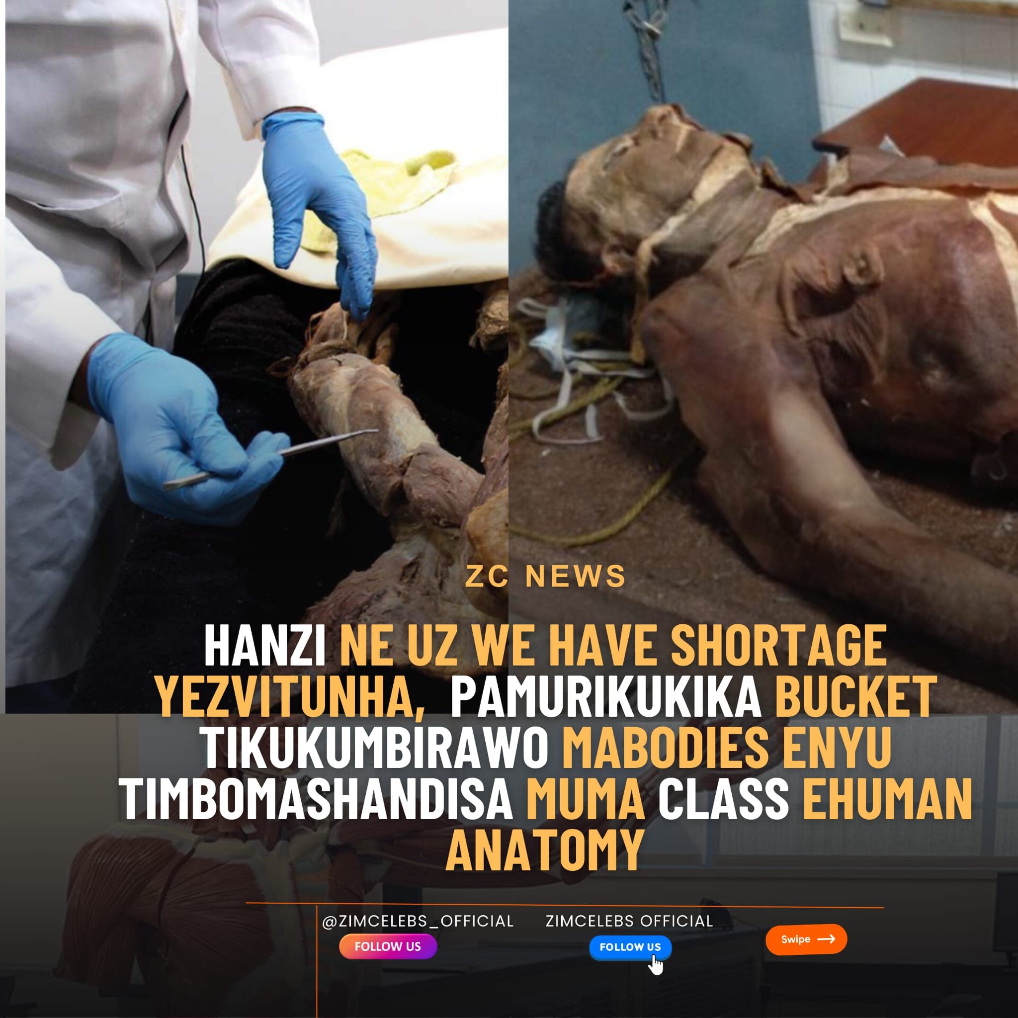 UZ appeals for more cadaver donations